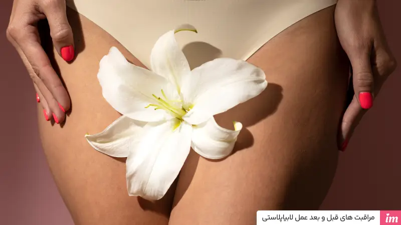 مراقبتهای قبل و بعد عمل لابیاپلاستی