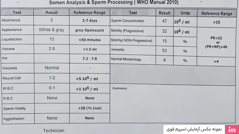  نمونه عکس آزمایش اسپرم قوی