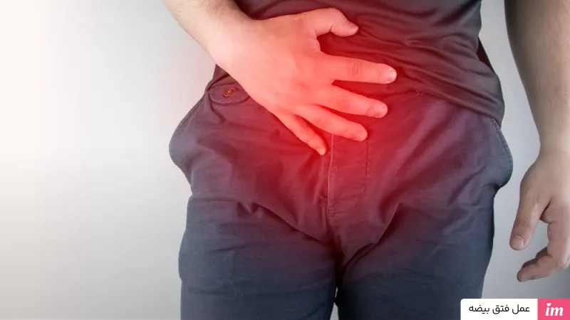 عمل فتق بیضه
