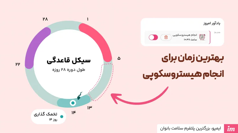 بهترین زمان برای انجام هیستروسکوپی