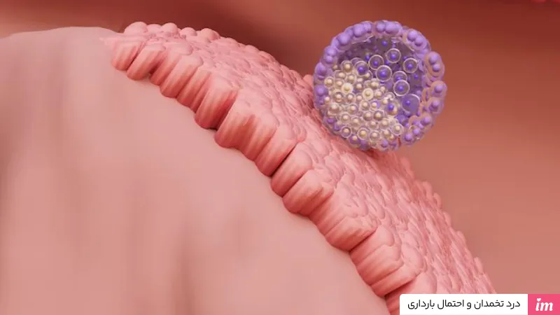 درد تخمدان و احتمال بارداری