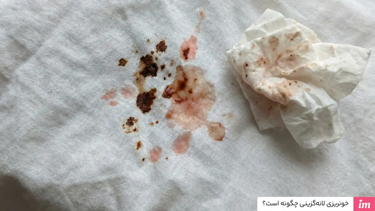 عکس واقعی خونریزی لانه گزینی