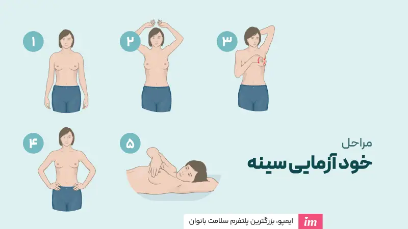 مراحل تست سرطان سینه در منزل
