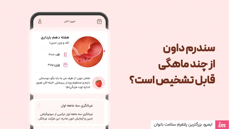 سندروم داون از چند ماهگی قابل تشخیص است