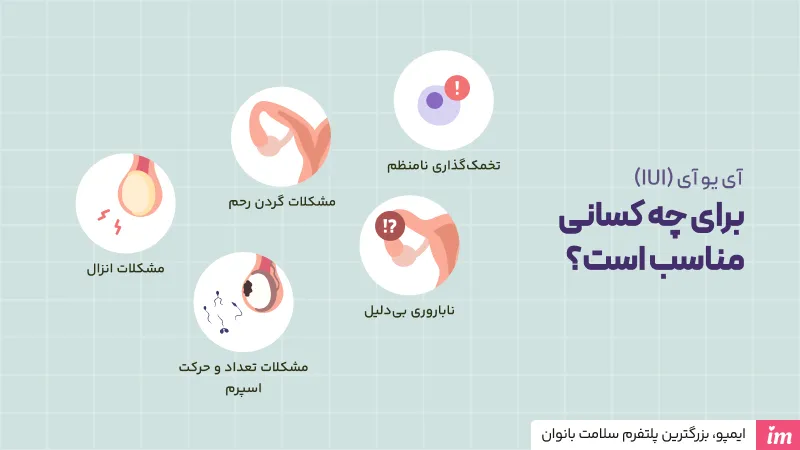 درمان آی یو آی برای چیست