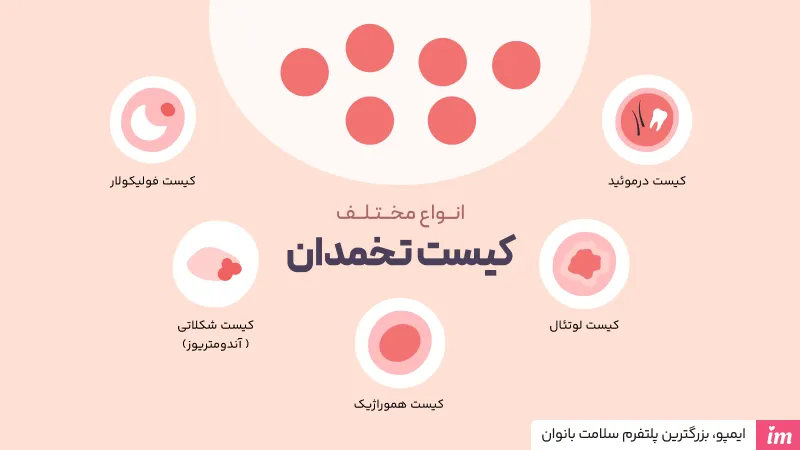 عکس کیست تخمدان