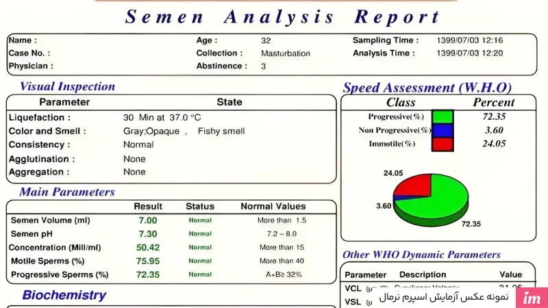 عکس جواب آزمایش اسپرم نرمال