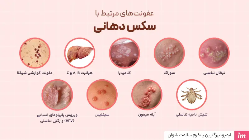 عفونت‌های مرتبط با سکس دهانی