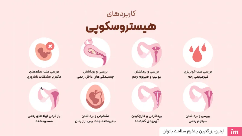 هیستروسکوپی برای چیست؟