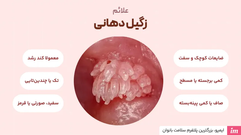 علائم زگیل دهانی چیست