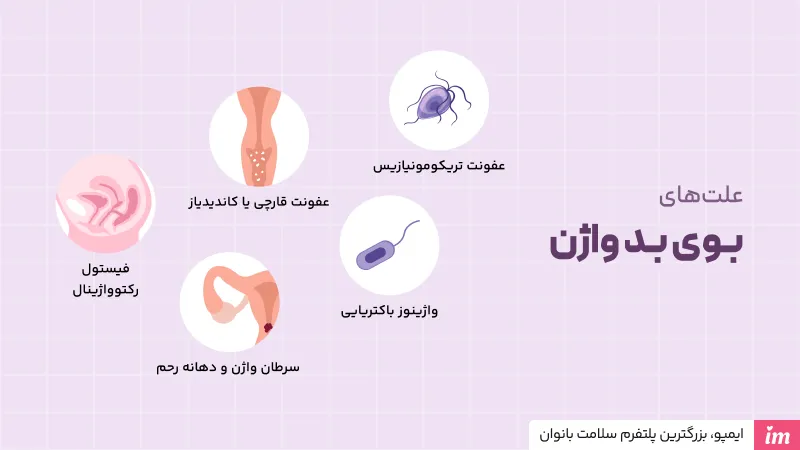 علت بوی بد واژن