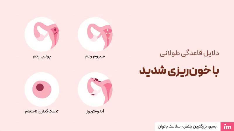 علت طولانی شدن پریود با خونریزی زیاد