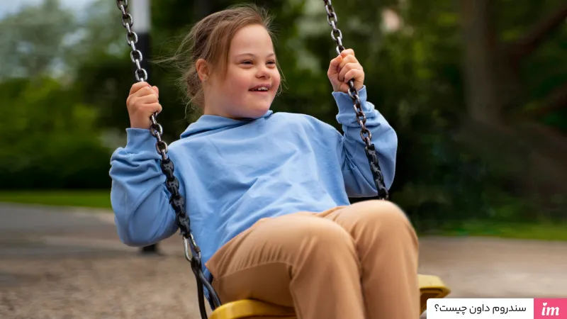 سندروم داون چیست