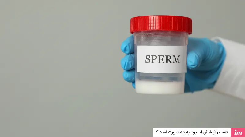 تفسیر آزمایش اسپرم و عکس جواب آزمایش اسپرم 