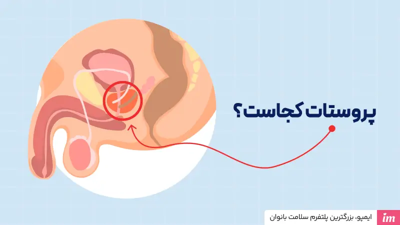 پروستات کجاست