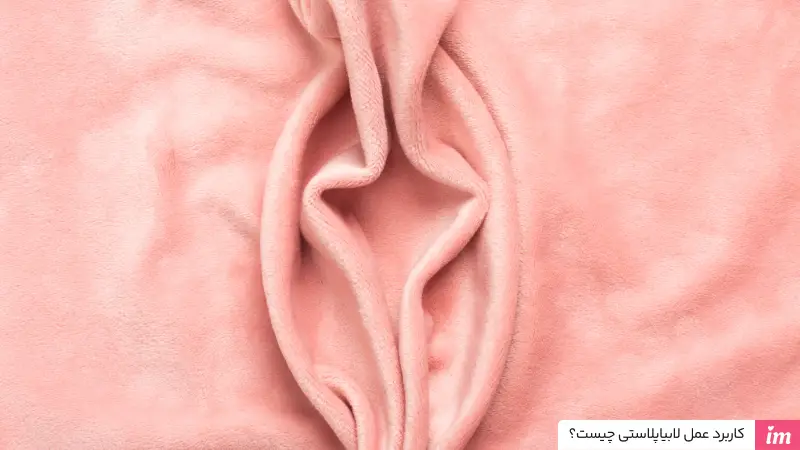 کاربرد عمل لابیاپلاستی چیست؟