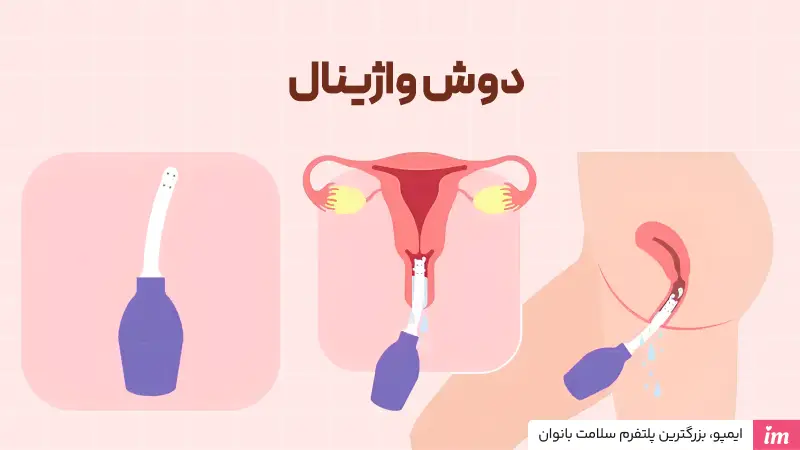 دوش واژینال چیست؟