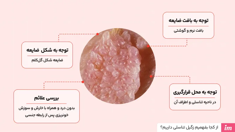 از کجا بفهمیم زگیل تناسلی داریم؟