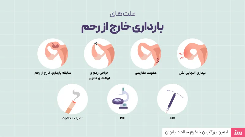 علت بارداری خارج از رحم