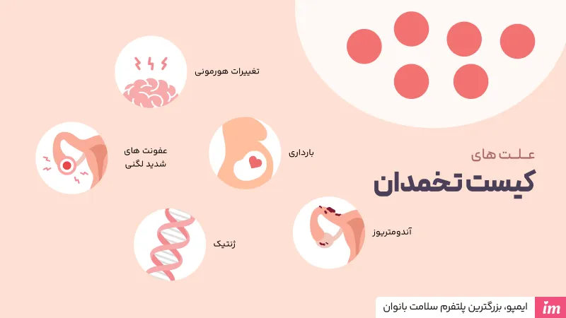 علت کیست تخمدان چیست؟