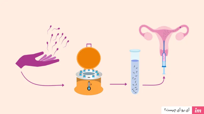 آی یو آی چیست