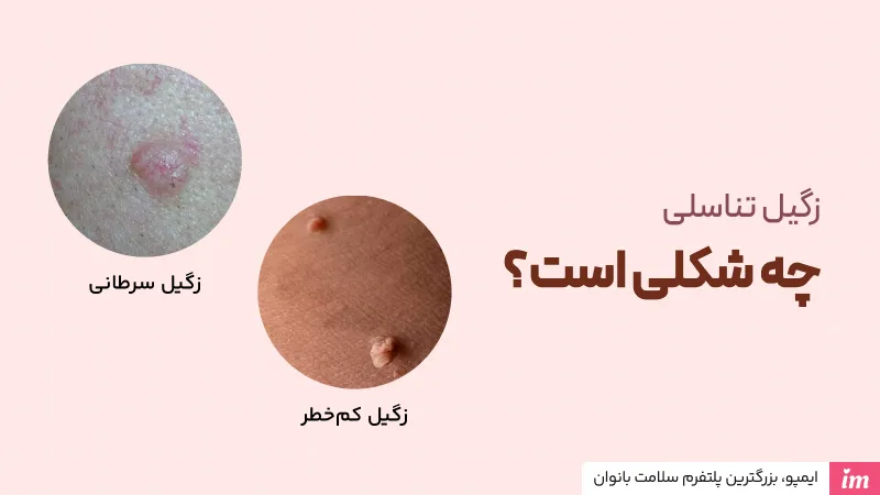 عکس زگیل تناسلی