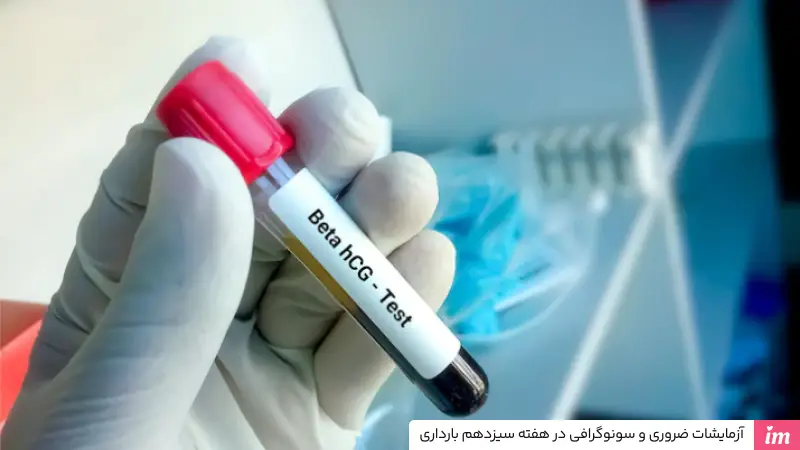 آزمایشات ضروری در هفته سیزدهم بارداری