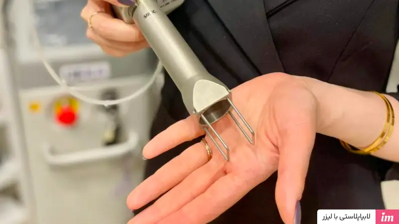 لابیاپلاستی با لیزر