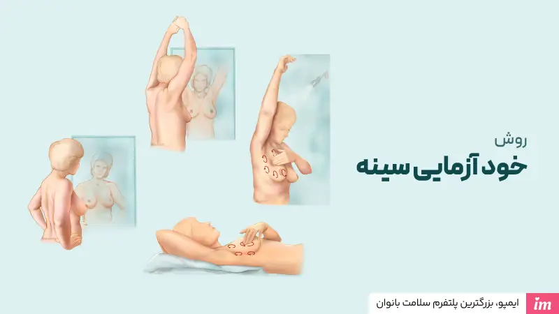 روش خودآزمایی سینه در منزل